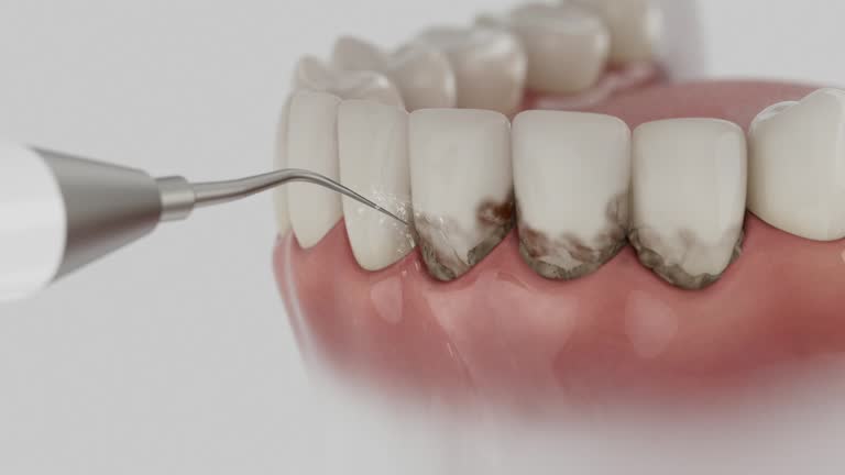 Reliable Tooth Extraction contractor in Mitchell County County, GA by Dentist Open Now